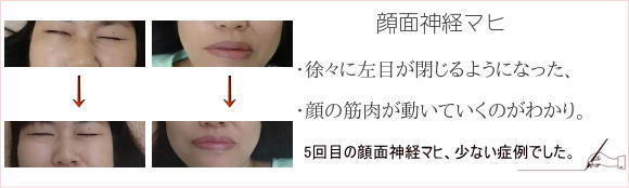 ��ʃ}�q�Ǘ�